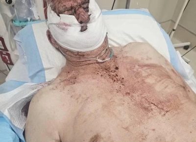 (Another) Henties Bay Pensioner Falls Victim to Alleged Panga-armed Robbers